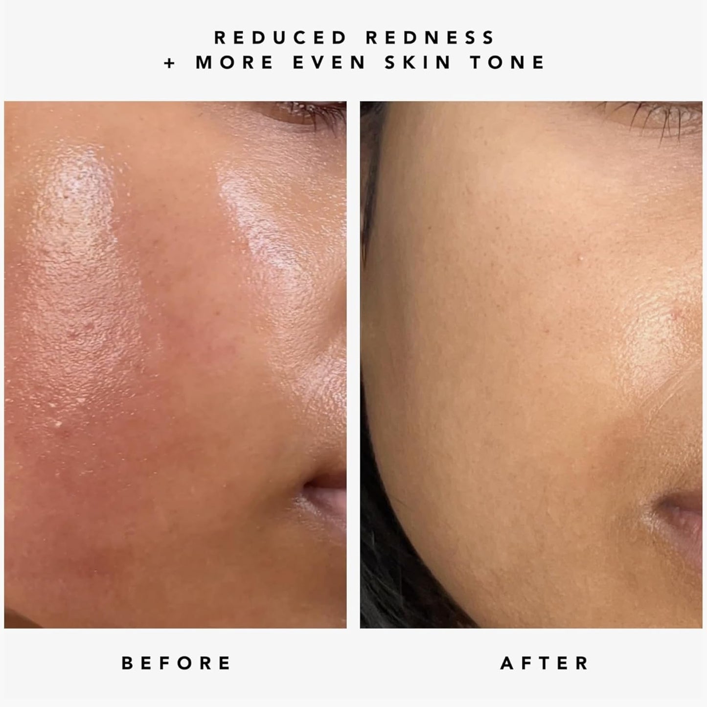 Elevate Your Skincare Ritual: HERBIVORE AM to PM Serum Duo for Radiant Skin Day and Night