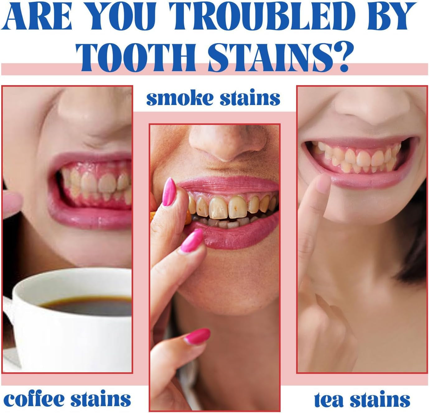 SP-6 Ultra Whitening Toothpaste - Deep Cleaning with Probiotic Balance for Fresh Breath (1 Pcs)